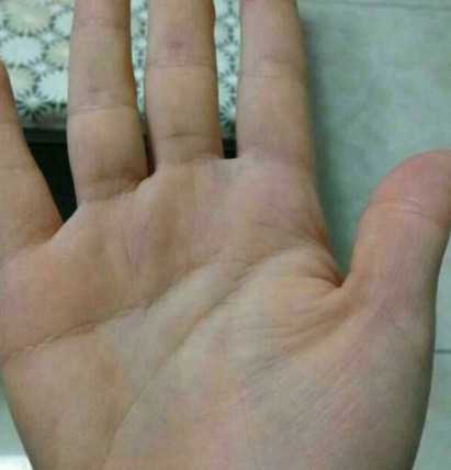 手纹好乱命不好吗?【手纹路乱女人命苦吗】