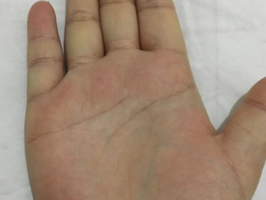 手纹好乱命不好吗?【手纹路乱女人命苦吗】