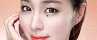 嘴角痣代表什么意思【嘴角痣叫什么】