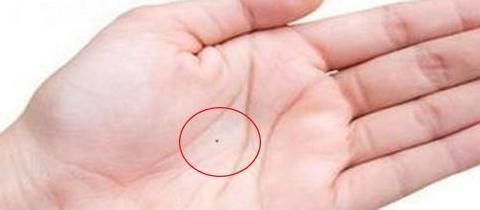 嘴角痣代表什么意思【嘴角痣叫什么】