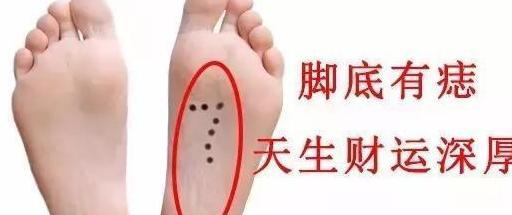 嘴角痣代表什么意思【嘴角痣叫什么】