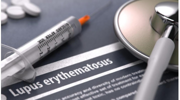 sln函数【sle医学上是什么意思】