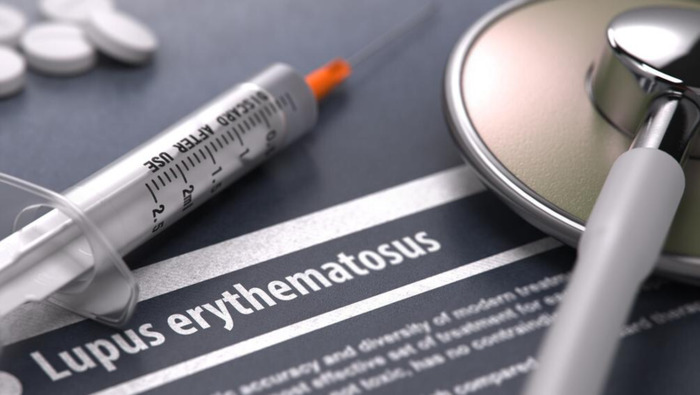 sln函数【sle医学上是什么意思】