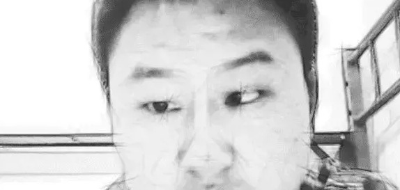 眉毛上面的骨头凸起面相婚姻【眉毛处骨头凸起来面相】