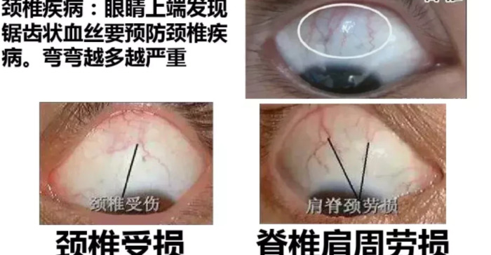 人体面部结构图侧面【人体面部结构图分布图】