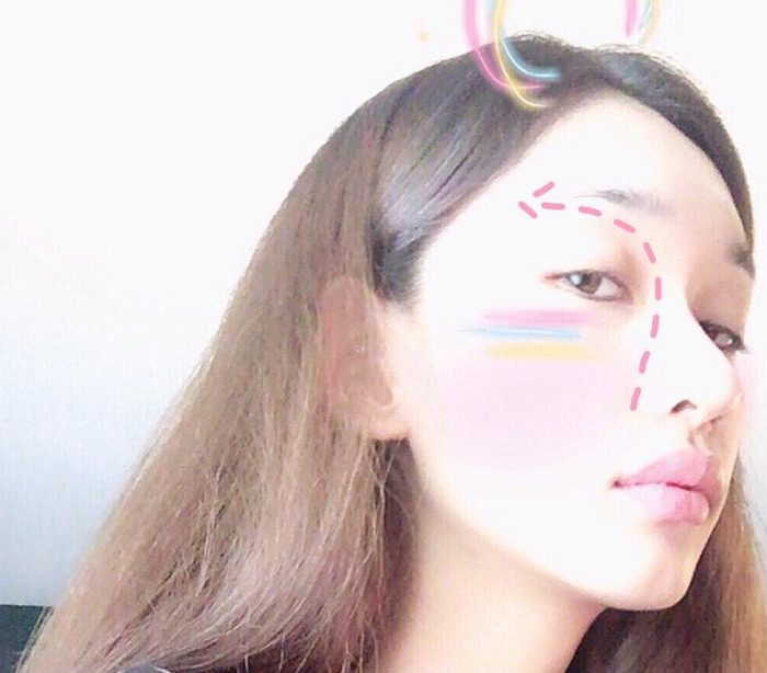 8个步骤捏出高鼻梁男【捏高鼻梁的正确方法】