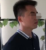 眉毛上方两个鼓包面相【两眉中间有鼓包面相上可好】