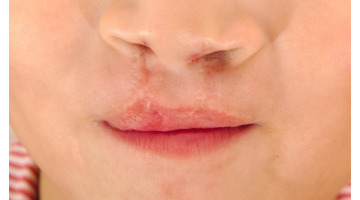 刘海云医生预约挂号【刘海云口腔专家简介】