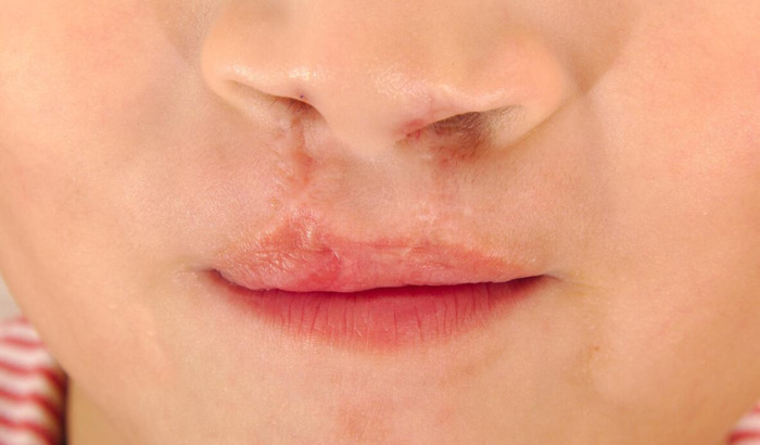 刘海云医生预约挂号【刘海云口腔专家简介】