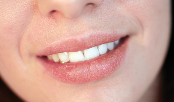 刘海云医生预约挂号【刘海云口腔专家简介】