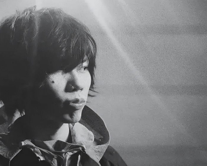 米津玄师马凡氏综合症治好了吗【米津玄师马凡氏综合症寿命】