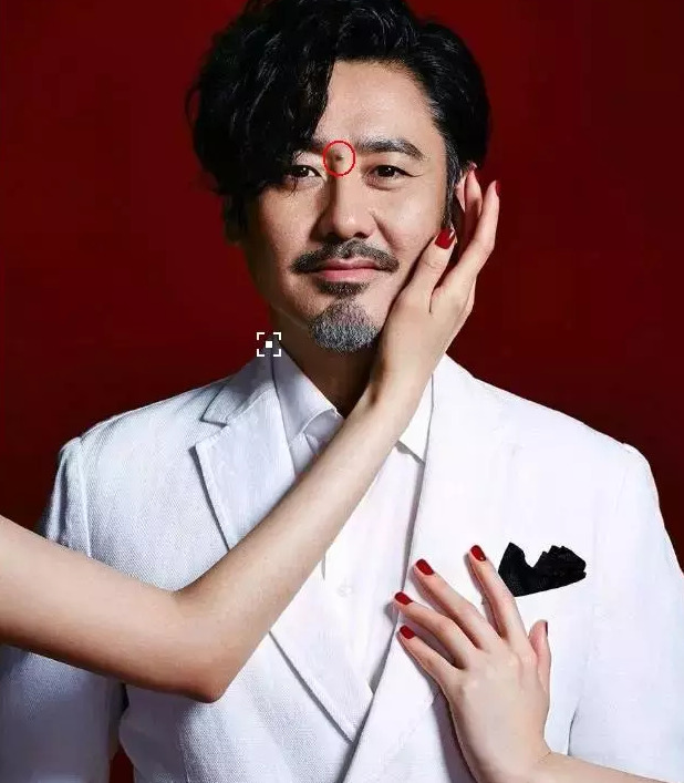 双生痣是什么意思,可以去掉吗【双生痣点掉会有什么影响】