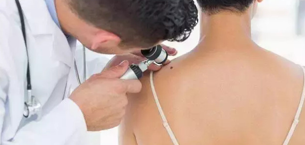 双生痣是什么意思,可以去掉吗【双生痣点掉会有什么影响】