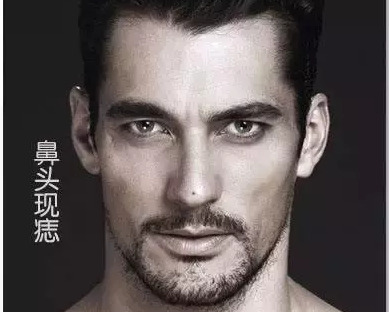 双生痣是什么意思,可以去掉吗【双生痣点掉会有什么影响】