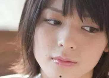 双生痣是什么意思,可以去掉吗【双生痣点掉会有什么影响】