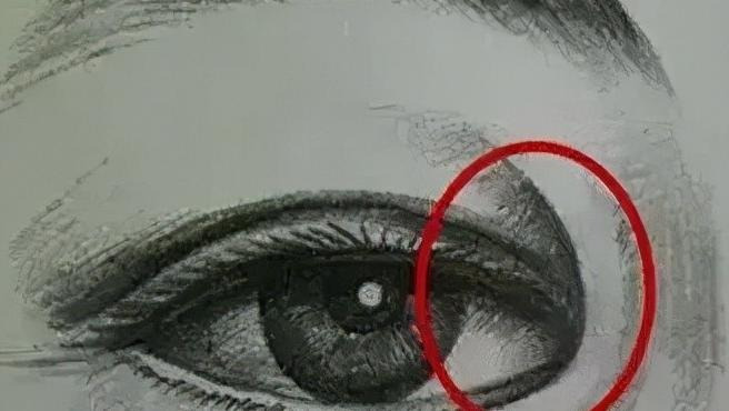 眼部整形培训【眼部整形术】