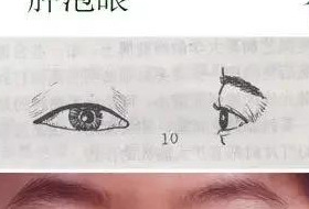 眼部整形培训【眼部整形术】