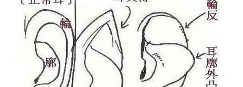 耳朵大的男人的命运【耳朵小的男人的命运,没有福气】