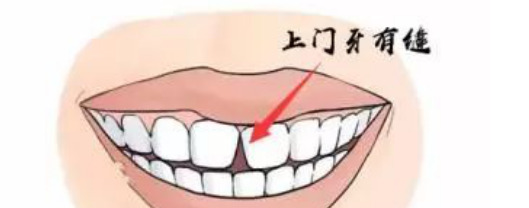 多长一颗牙有什么寓意【上面长一个牙是什么意思】