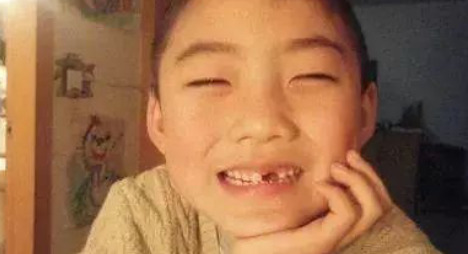 多长一颗牙有什么寓意【上面长一个牙是什么意思】