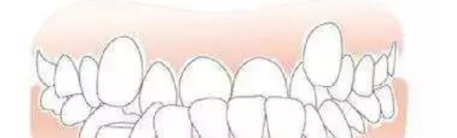 多长一颗牙有什么寓意【上面长一个牙是什么意思】