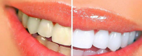 多长一颗牙有什么寓意【上面长一个牙是什么意思】