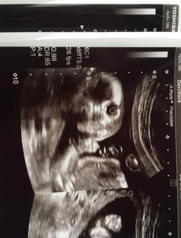 做b超图片【我就看你们装B的图片】