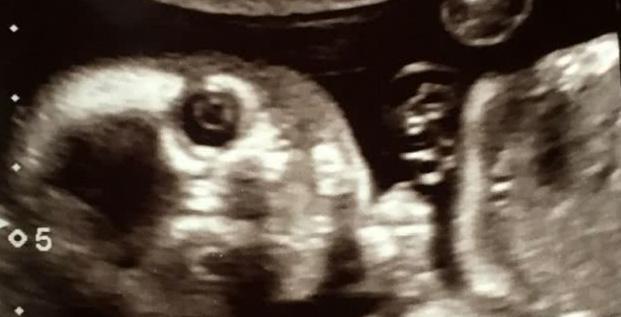 做b超图片【我就看你们装B的图片】