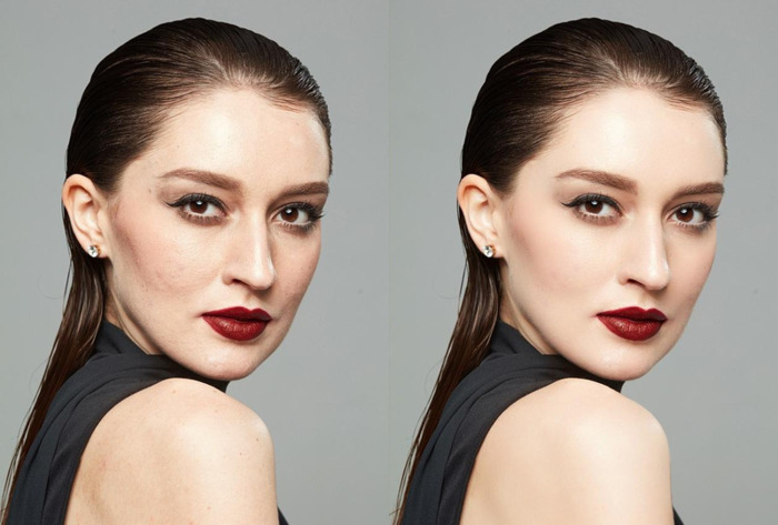 ps如何修皮肤【ps去掉痘痘教程磨皮】