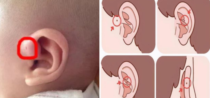 耳垂大小和福气有关吗男子【耳垂大有福气还是耳垂厚有福气】