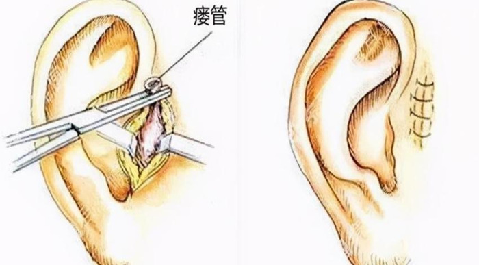 耳垂大小和福气有关吗男子【耳垂大有福气还是耳垂厚有福气】