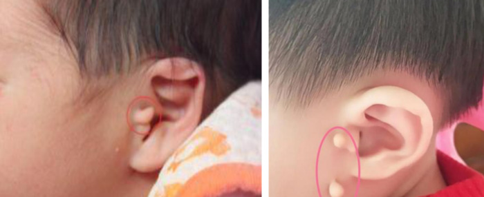 耳垂大小和福气有关吗男子【耳垂大有福气还是耳垂厚有福气】