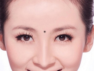 风水点痣你们相信吗【不能乱点痣】