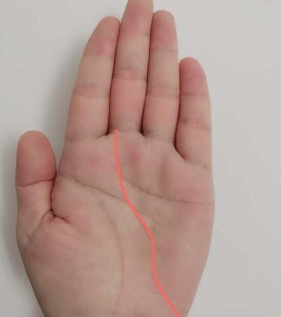 好多人都有悬针纹【有悬针纹的】