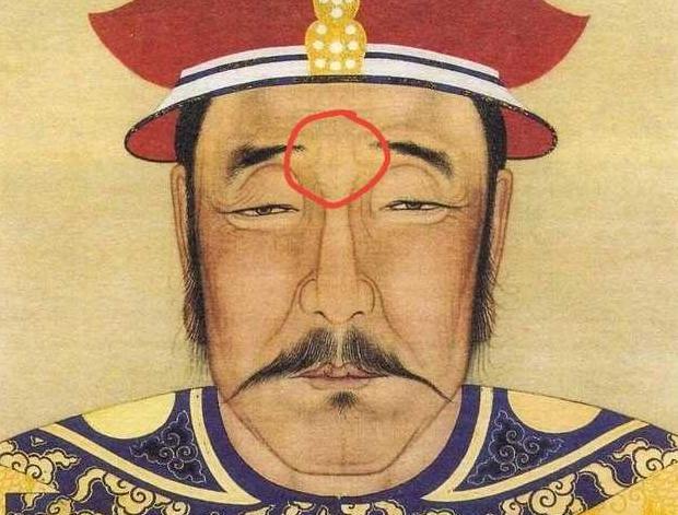 好多人都有悬针纹【有悬针纹的】