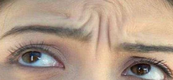 好多人都有悬针纹【有悬针纹的】