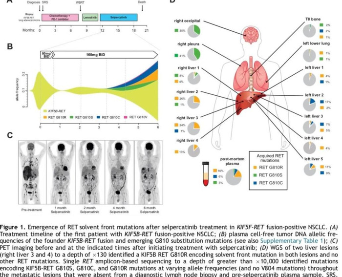 Rearranged during Transfection【Rearranged My Life】