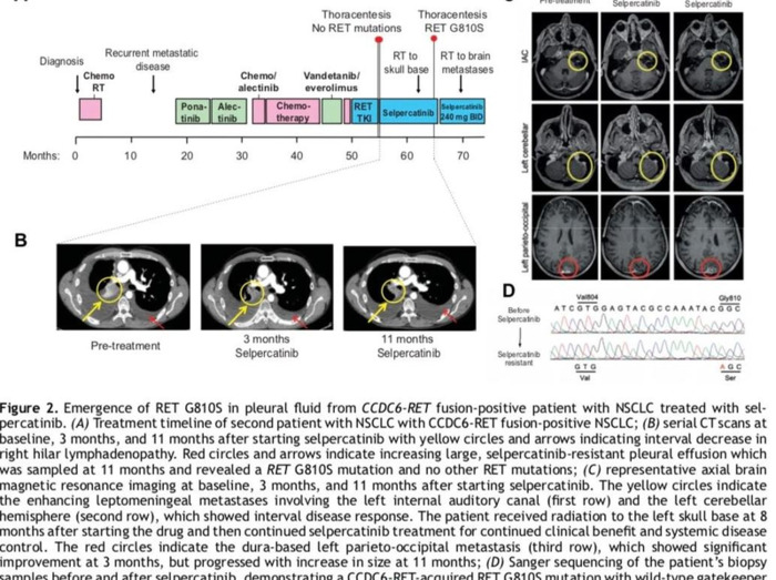 Rearranged during Transfection【Rearranged My Life】