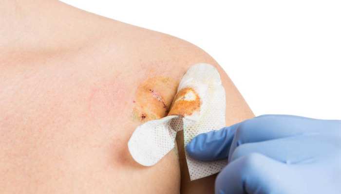 大拇指长痣是什么原因【右手大拇指长痣】