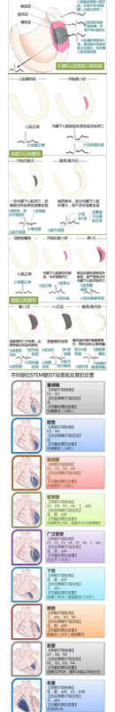 动态心电图【动态背景图】