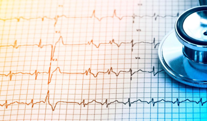 动态心电图【动态背景图】