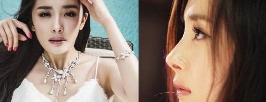 左单右双是龙凤眼吗【一个内双一个外双是龙凤眼吗】