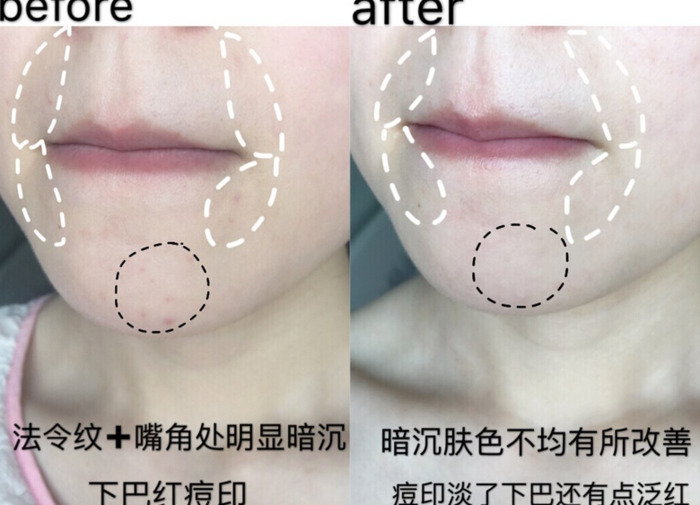 京润珍珠是不是真的【京润珍珠粉是真的吗】