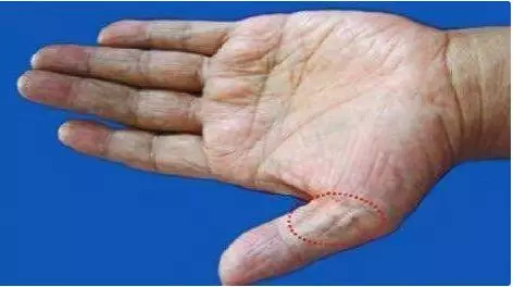 三高茶有什么作用【三高茶饮配方大全】