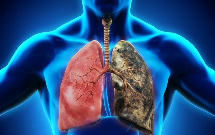 30年烟龄戒烟后各天的生理反应【戒烟后各天的生理反应表现】