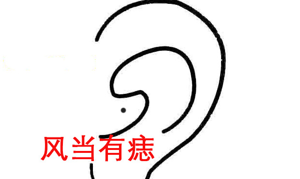 女人哪里有痣容易离婚【女人身上的四个离婚痣】