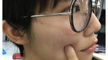 侧脸靠近耳朵附近有痣好不好【侧脸靠近耳朵附近有痣代表什么】