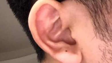 侧脸靠近耳朵附近有痣好不好【侧脸靠近耳朵附近有痣代表什么】