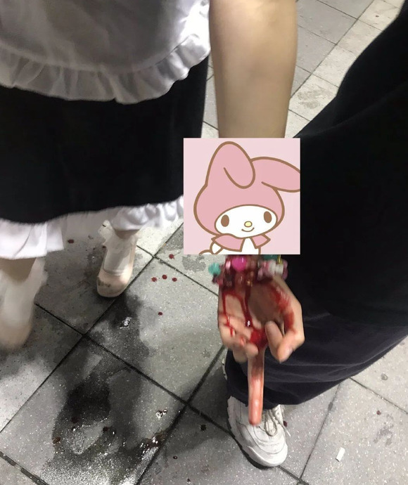 病娇有什么特征【病娇的十大特点】