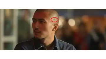 佛说胸前有痣的人【胸前有痣的人前世负过一个人佛教】